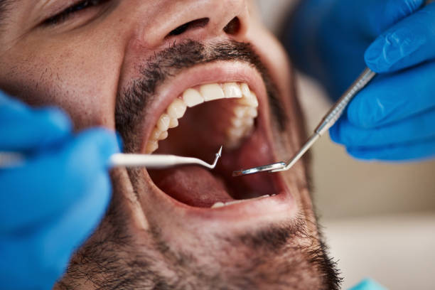 Best Broken or Cracked Tooth Emergency Dentist in Calumet Park, IL