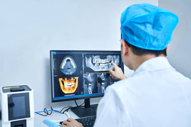 Best Emergency Dental Extractions in Calumet Park, IL